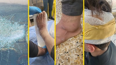 “نقلوا للمستشفى”.. رعاة يعتدون على عمال بلدية آلتون كوبري أثناء تفريغ النفايات