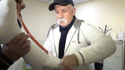 Kirkuk’s only prosthetics factory halts production