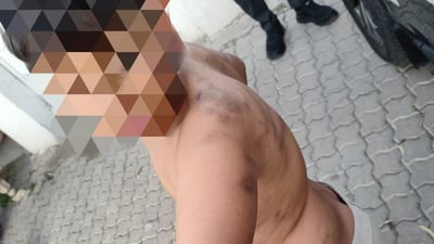 منداڵێک لەلایەن زڕباوکیەوە بەجگەرە و چەقۆی گەرم سوتێندراوە و داخکراوە