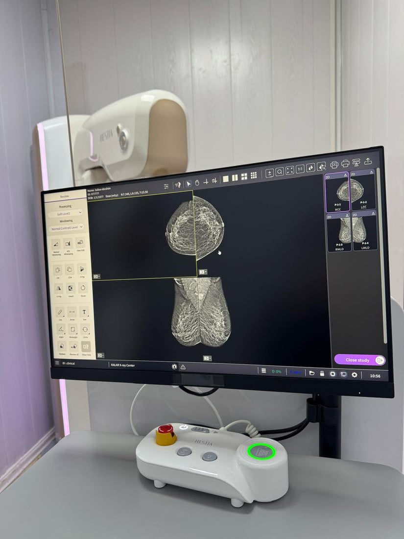 مامۆگرافی لە گەرمیان دانرا و مەچن بۆ هیچ شوێنێکی تر