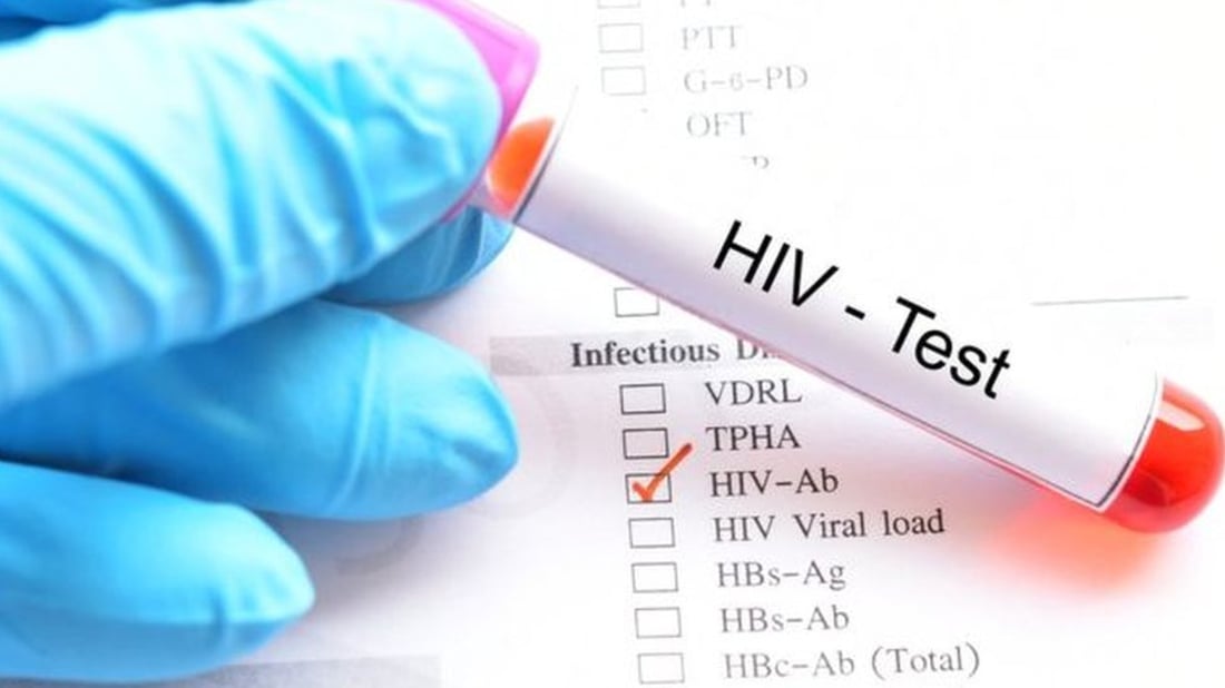 الأنبار تنفي تسجيل 92 إصابة بالإيدز في الفلوجة