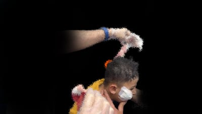 سەگ پەلاماری منداڵێکیدا و برینداریکرد 