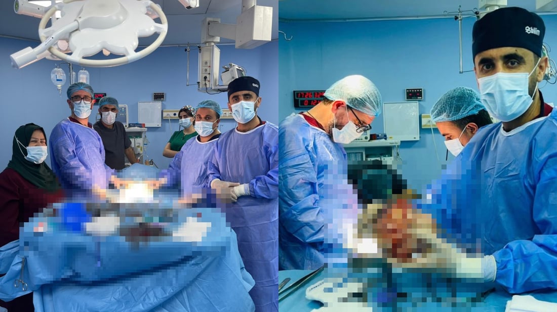 گرێیەکی گەورە لە سکی کچێکی 16 ساڵان دەرهێنراوە