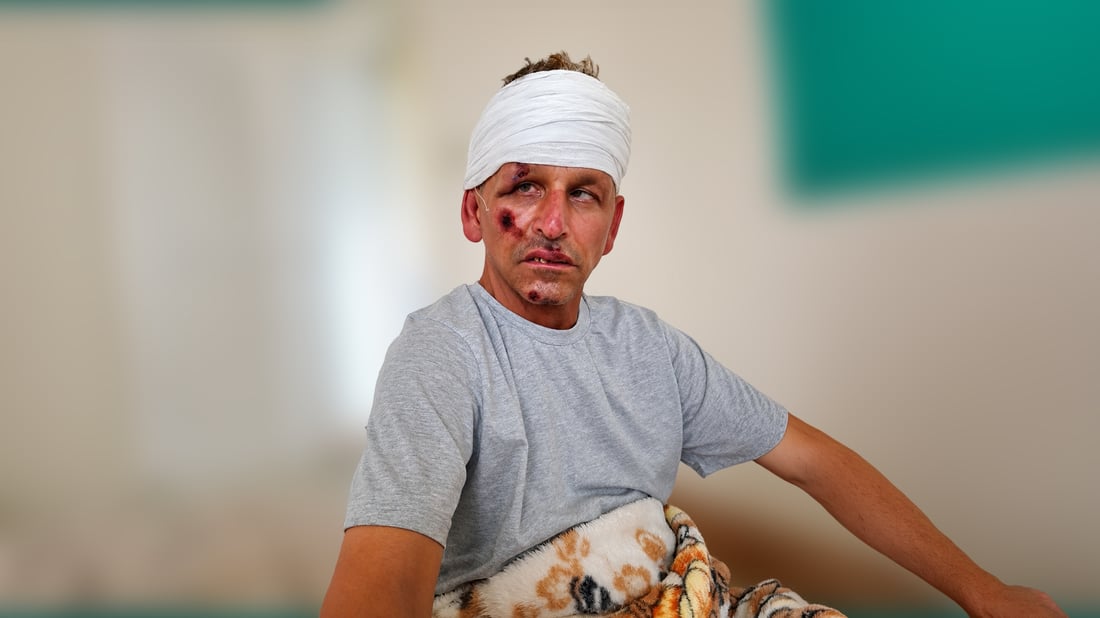 ئەحمەد تەپەڕەشی لە رووداوێکی هاتوچۆدا برینداربوو