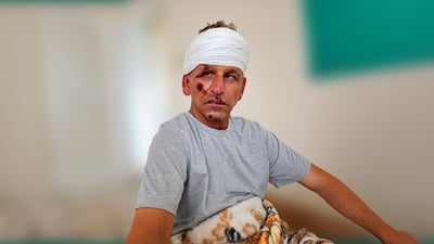 ئەحمەد تەپەڕەشی لە رووداوێکی هاتوچۆدا برینداربوو