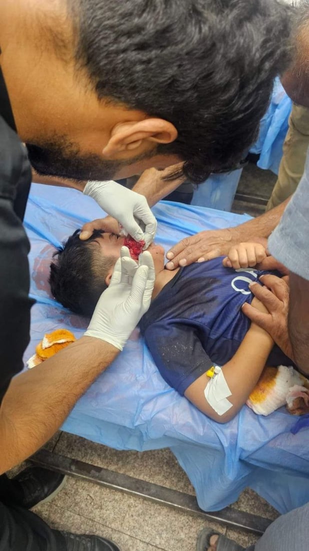 قطيع من الكلاب السائبة يهاجم 8 أطفال في الناصرية ويصيبهم بجروح متفاوتة