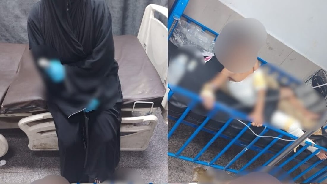سكب ماء مغلياً على زوجته وأطفاله ثم نقلهم إلى المستشفى فاعتقلته الشرطة