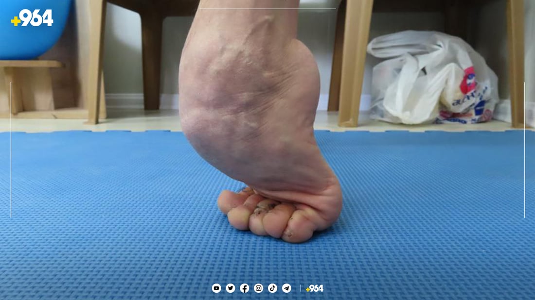 لە زاخۆ 30 نەشتەرگەری قورس بە خۆڕایی ئەنجامدەدرێت