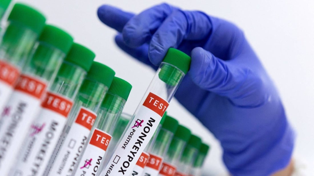 چیتر نەخۆشی ئاوڵەی مەیمون مەترسیدار نییە