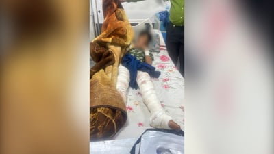 الصحة توضح ملابسات حادثة الزوراء: تمت معالجة الطفل ووضعه مستقر