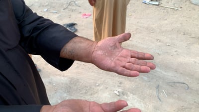 فيديو: جلود الناس تغيرت في شبانات كربلاء والخواطر مكسورة