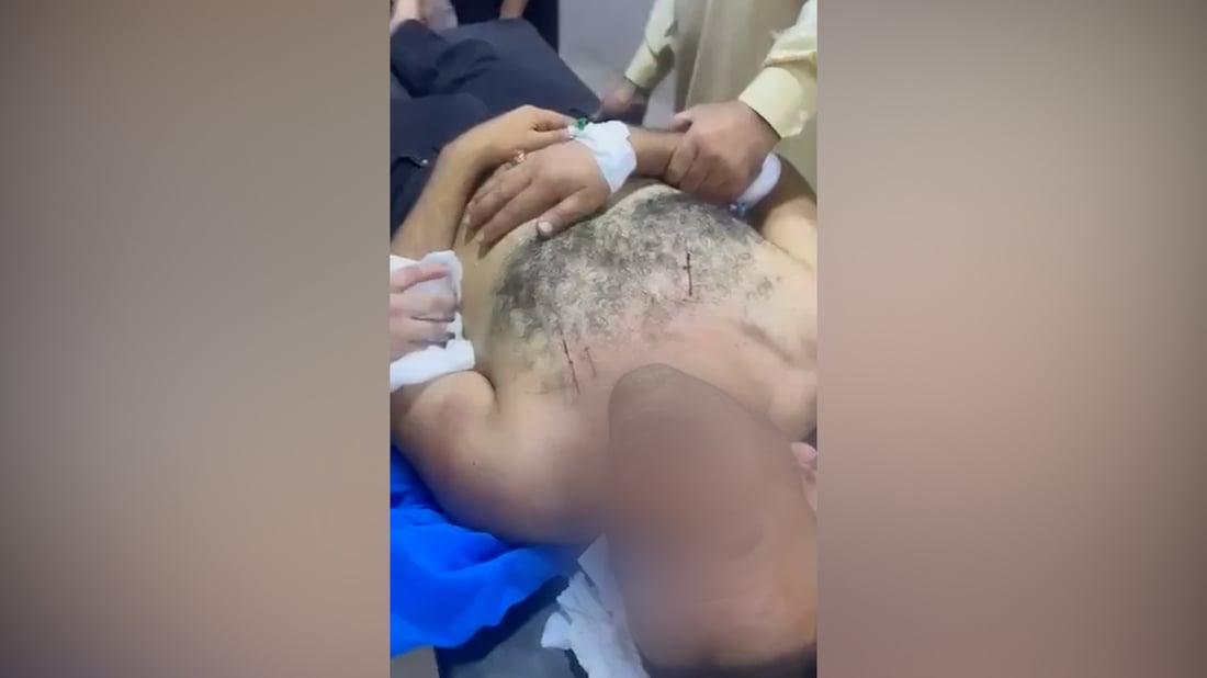الشرطة أوقفت نجلي النائب طه المجمعي وشقيقه بتهمة طعن شاب في بعقوبة