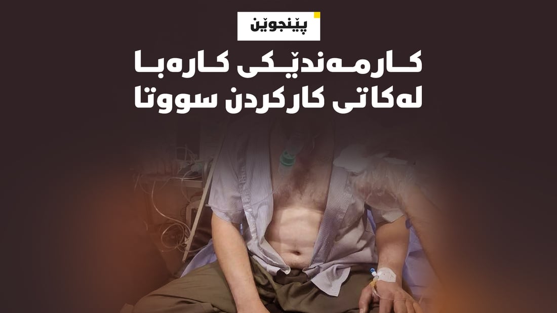 دەموچاوی کارمەندێکی کارەبای پێنجوێن سووتا