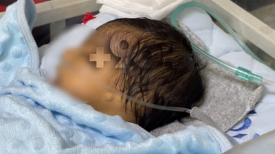 لە کەلار منداڵێک لەدایکبووە دڵى لاى راستە و گوێچکەشى نیە