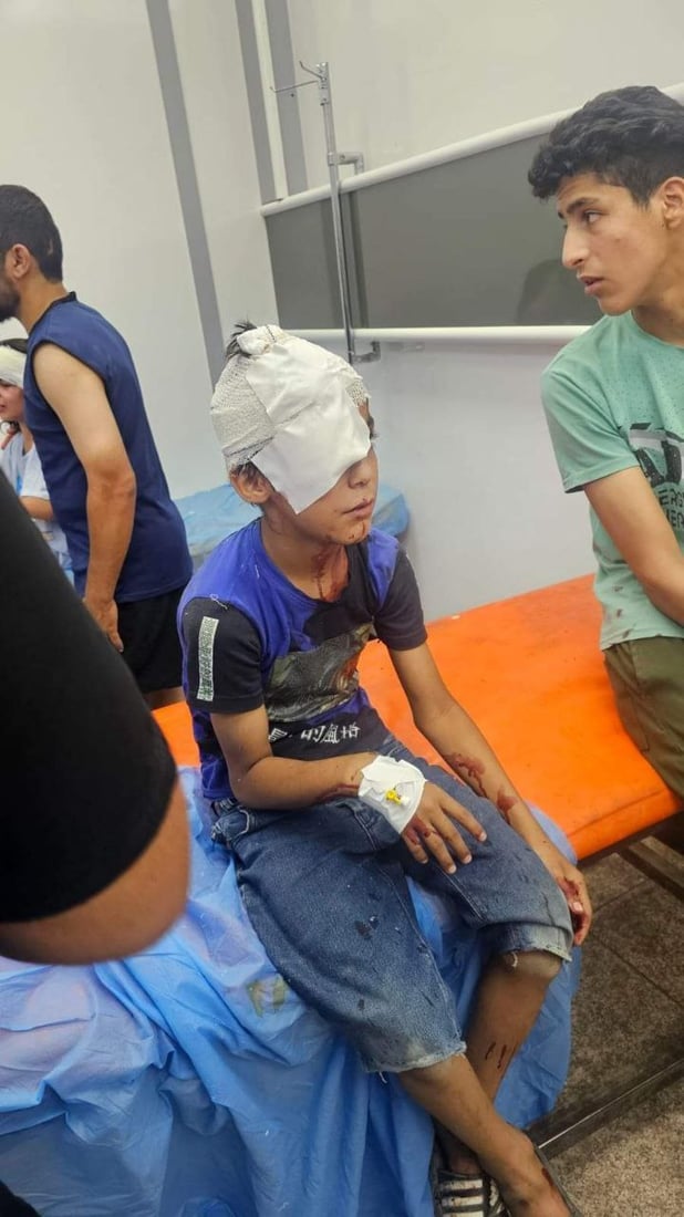 قطيع من الكلاب السائبة يهاجم 8 أطفال في الناصرية ويصيبهم بجروح متفاوتة