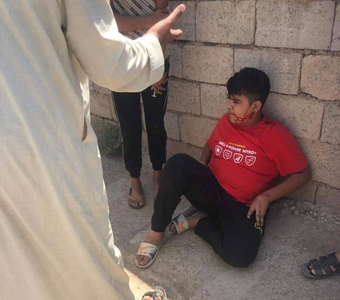 صور: 3 مراهقين سرقوا سيارة والدهم واصطدموا بجدار دكان في كركوك