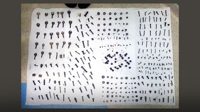 سێ کیلۆ بورغو و كلیل لە گه‌ده‌ی نه‌خۆشێكدا دەرهێندران