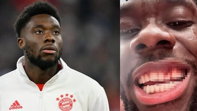 بایرن خەریک بوو ددانەکانی لەدەست بدات!