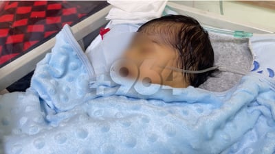 چیرۆکی ئەو منداڵەی دڵی لەلای راست بوو کۆتایی هات