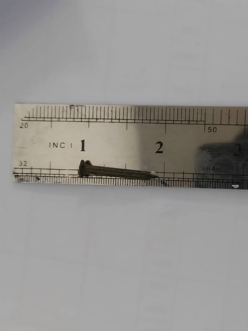 بزمارێک لە گەروی هاوڵاتییەک دەرهێنرا