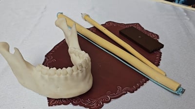 ئامێرێک بۆ لابردنی کلۆری ددان؛ “9000 ساڵ پێش بەکارهاتووە”