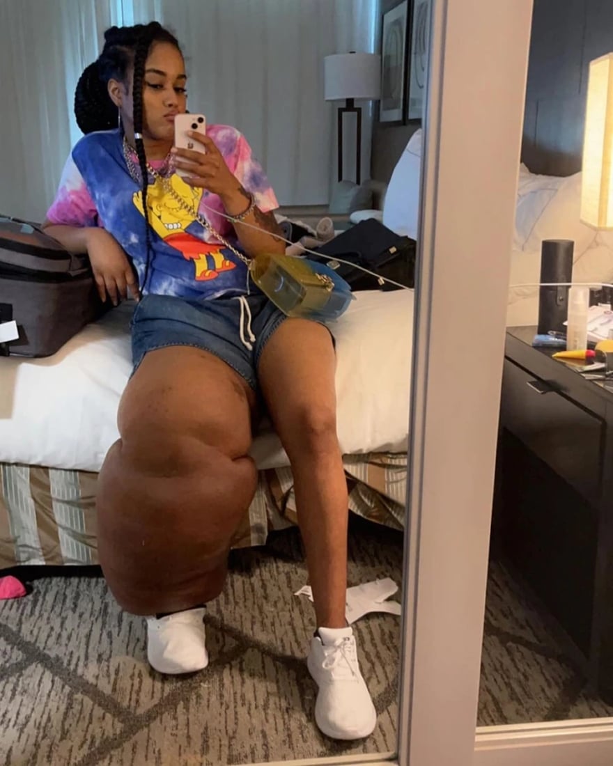 بە قاچێکی 45 کیلۆییەوە بوو بە مۆدێل