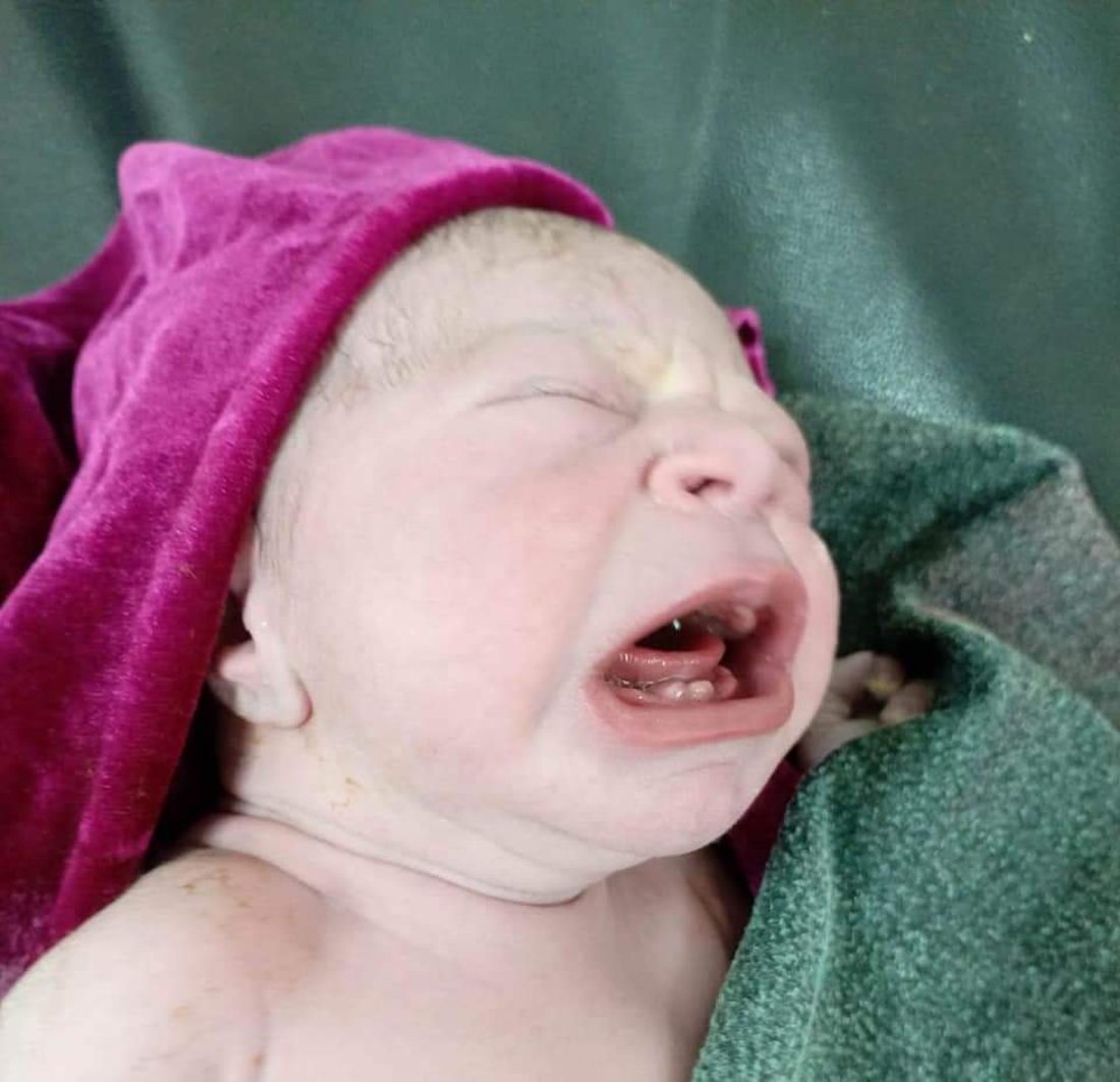 صور: ولادة طفلة بأسنان لبنية في مستشفى تلعفر.. المخاض طبيعي والأم بخير