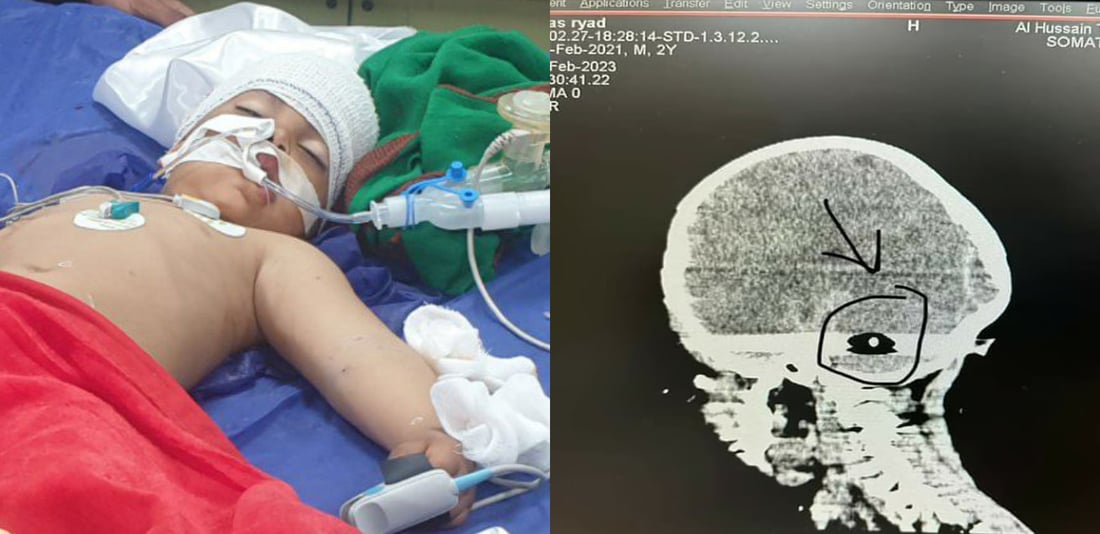السماوة: إثر رصاصة طائشة.. الطفل عباس يفارق الحياة بعد 5 أيام من الغيبوبة