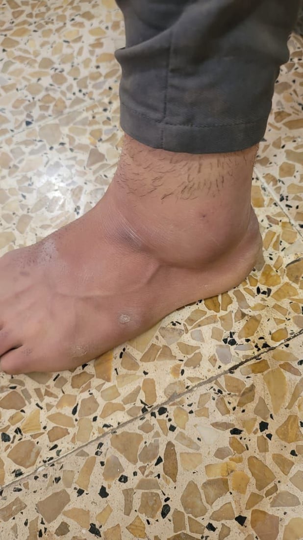 “نقلوا للمستشفى”.. رعاة يعتدون على عمال بلدية آلتون كوبري أثناء تفريغ النفايات