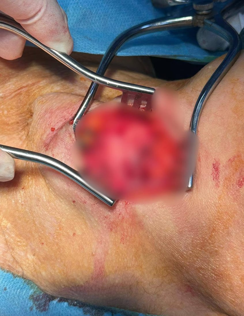 نەشتەرگەرییەکی دەگمەنی بۆ کرا و دوای پێنج ساڵ گوێی لە دەنگی ئاسایی خۆی بوو