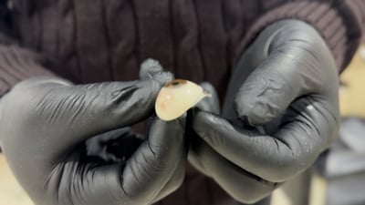 سنجار “تزرع العيون”! فحوص معقدة “شبكية ومخروطية” عند د. أردلان