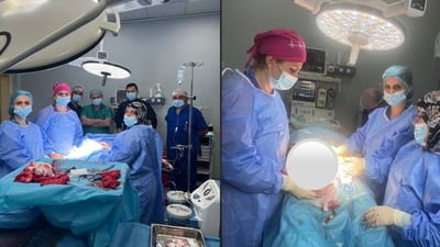 ژیانی کۆرپەلەیەک رزگارکرا؛ وێڵاشی لکابوو بە منداڵدانی دایکی