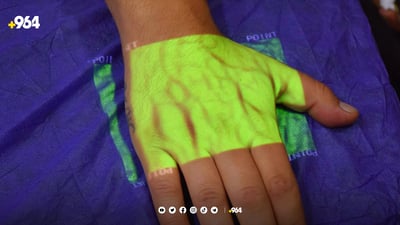 بۆ یەکەمجار ئامێرێکی پزیشکی نوێ هێنراوەتە نەخۆشخانەی خانەقین