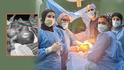 ئەمڕۆ ناوەندە تەندروستییەکانی کەرکوک رۆژەکەیان بە نەشتەرگەرییەکی دەگمەن و ئاڵۆز تێپەڕاند