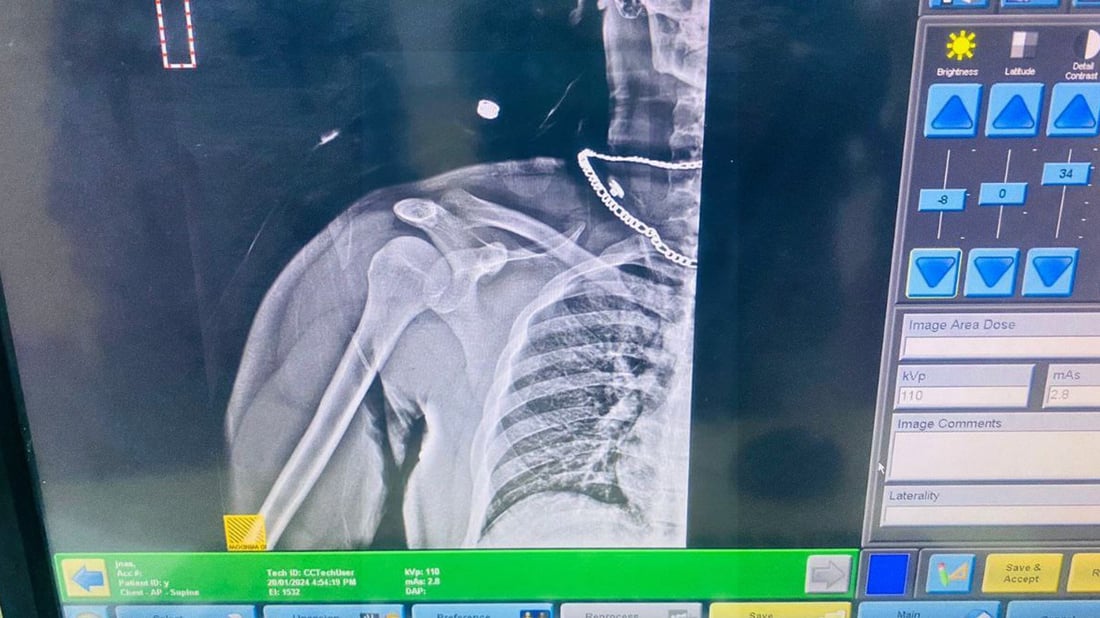 پۆلیسێکی هاتوچۆ لە لایەن شۆفێرێکەوە بریندار کرا