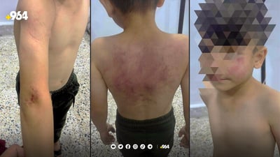 باوکێک بە تۆمەتی ئازاردانی منداڵەکەی دەستگیرکرا