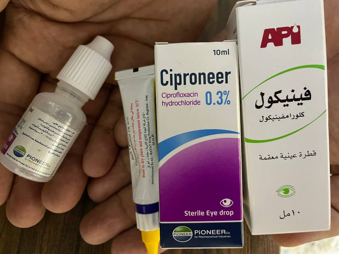 أشهرهن “نوعة”.. أمهات “القشة” يداوين العيون في مدينة الصدر.. وابن الهيثم يحذّر