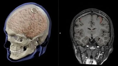 لە رێگەی مێشکەوە دەتوانیت کار بە ئامێرەکان بکەیت