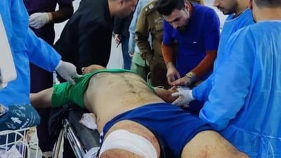 الكوت: مسلح متنكّر بكمامة يطلق 4 رصاصات على سائق تاكسي ويسرق سيارته
