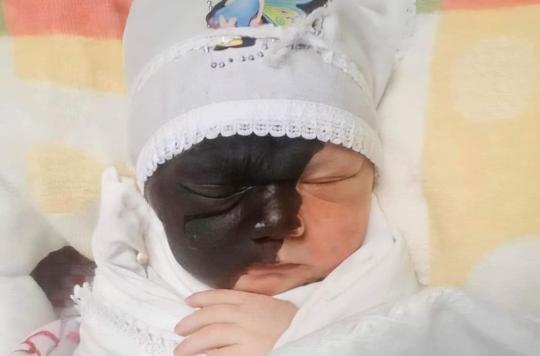 “هیچ حاڵەتێکی دەگمەنی لەدایکبوون لە کەرکوک تۆمار نەکراوە”