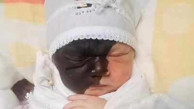 “هیچ حاڵەتێکی دەگمەنی لەدایکبوون لە کەرکوک تۆمار نەکراوە”