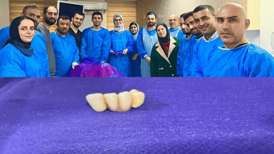 چوار ددانی تاخم لە سورێنچکی نەخۆشێک دەرهێنران